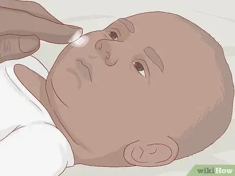 Image titled Treat Your Baby's Eczema Step 10