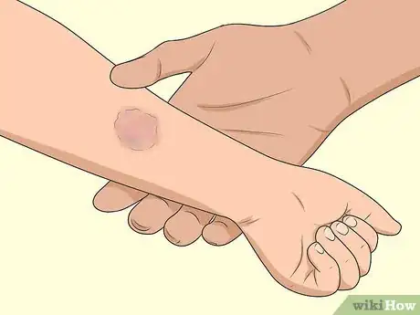 Image titled Handle Preschool Bullies Step 2