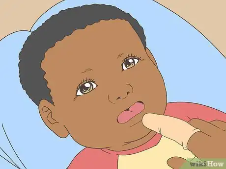 Image titled Clean an Infant's Mouth Step 5