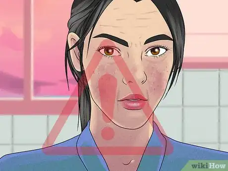 Image titled Reduce Menopausal Acne Step 6