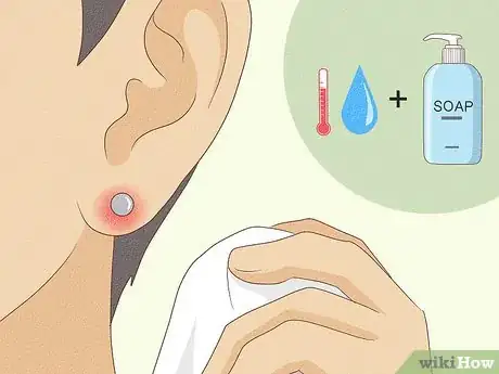 Image titled Treat Infected Piercings Step 2