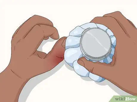 Image titled Wrap a Sprained Thumb Step 12
