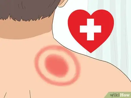 Image titled Beat Lyme Disease Step 1