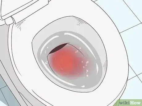 Image titled Know if You Have Internal Bleeding Step 8