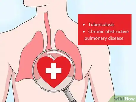 Image titled Prevent Lung Cancer Step 5