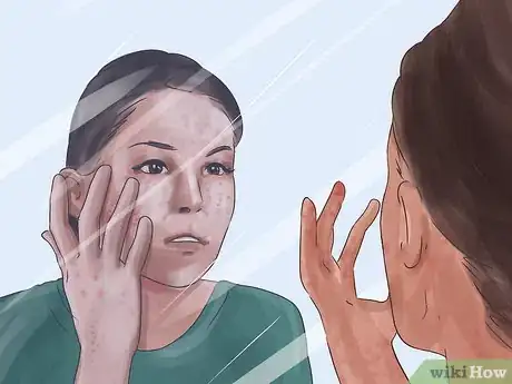 Image titled Stop Dermatillomania Step 6