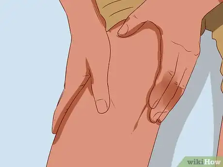 Image titled Manage Tuberculosis Step 8