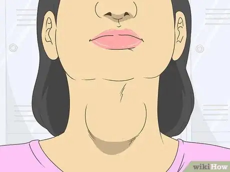 Image titled Diagnose Hashimoto's Step 5