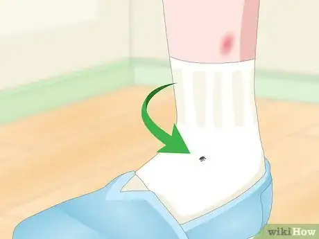Image titled Detect Flea Bites Step 5