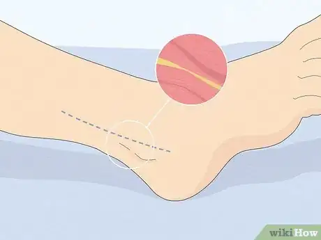 Image titled Find a Neurologist Step 12