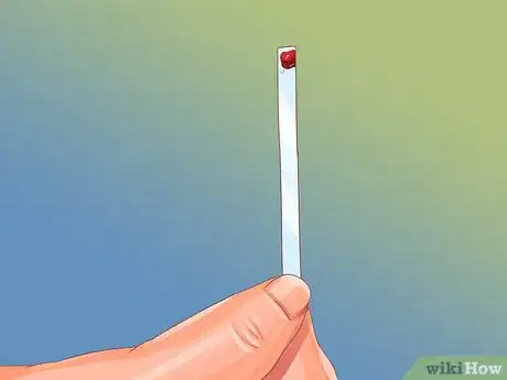 Image titled Collect Bodily Fluid Samples from a Cat Step 5