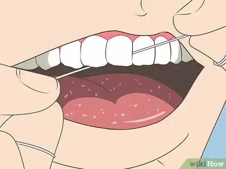 Image titled Avoid Hurting Your Gums Step 11