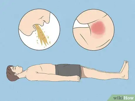 Image titled Diagnose Laryngopharyngeal Reflux Step 4