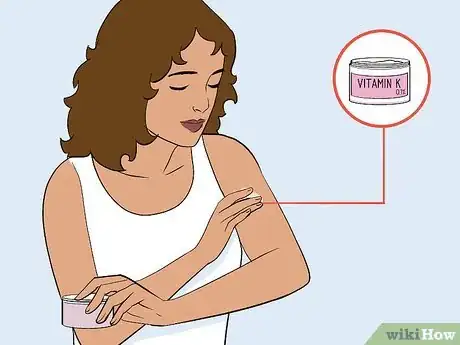 Image titled Care for a Bruise Naturally Step 3