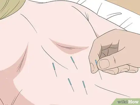 Image titled Treat Neck and Back Pain Naturally Step 4