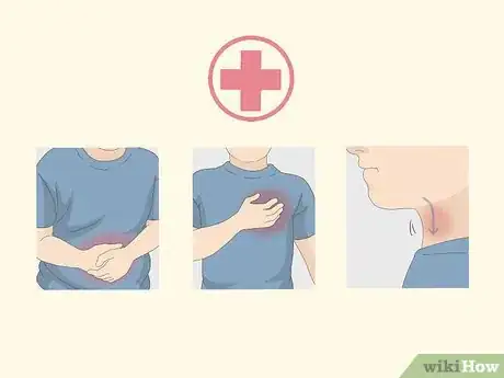 Image titled Check a Fever Without a Thermometer Step 11