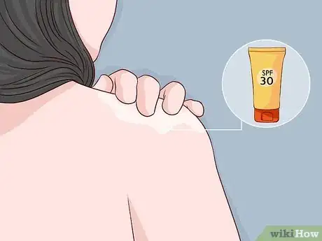 Image titled Treat Sunburn with Natural Remedies Step 7