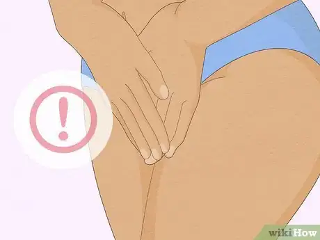 Image titled Prevent BV (Bacterial Vaginosis) Step 11