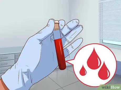 Image titled Get Immunized Against Chicken Pox Step 11