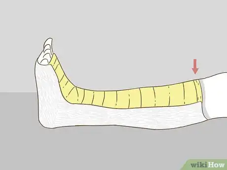 Image titled Apply Splints Step 21