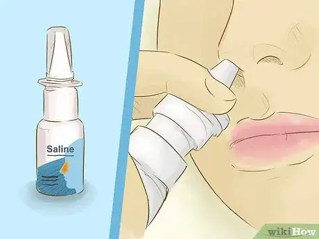 Image titled Stop a Cold when You Feel It Coming On Step 11