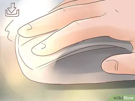 Image titled Apply for Disability Benefits Step 6