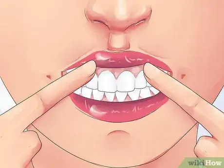 Image titled Handle Tooth Loss Step 8