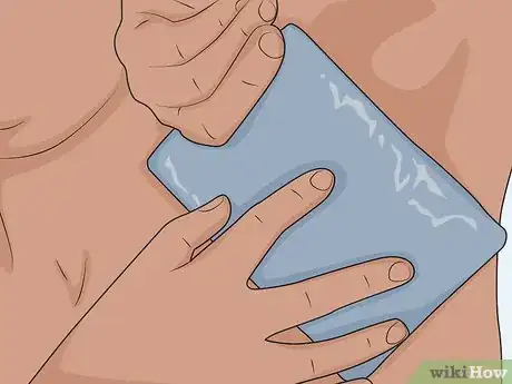 Image titled Heal Armpit Rash Step 2