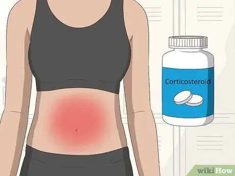 Image titled Prevent Crohn's Disease Step 1