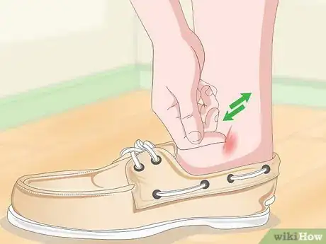 Image titled Detect Flea Bites Step 3