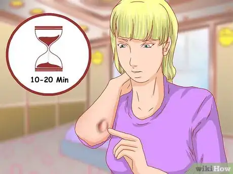 Image titled Recognize Frostbite Step 2