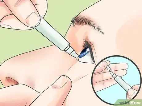 Image titled Reduce The Effects of Macular Degeneration Step 9