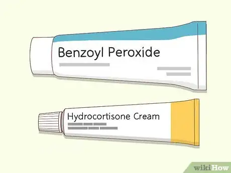 Image titled Prevent Cystic Acne Step 8