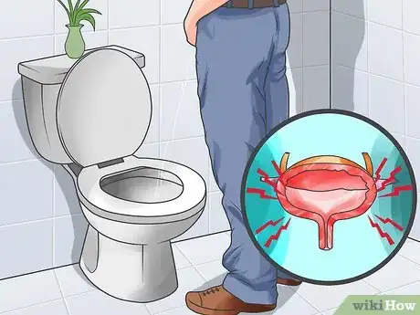 Image titled Know if You Have Prostate Cancer Step 6