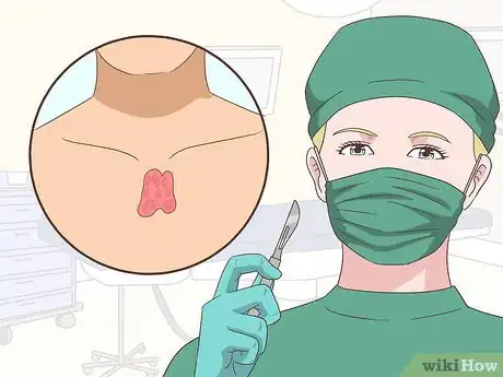 Image titled Treat Myasthenia Gravis Step 8