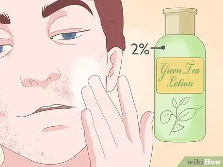 Image titled Use Herbs to Heal Step 3