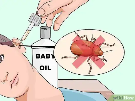 Image titled Get Something out of Your Ear Step 6