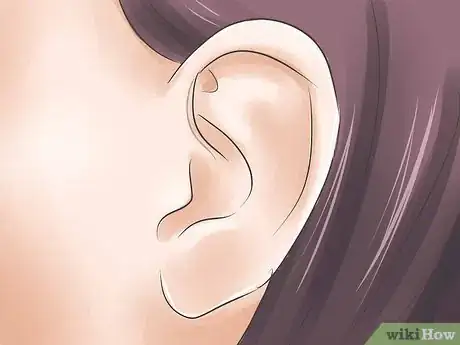 Image titled 1035918 10