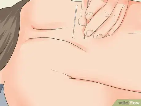 Image titled Relieve Back Pain Without Drugs Step 13