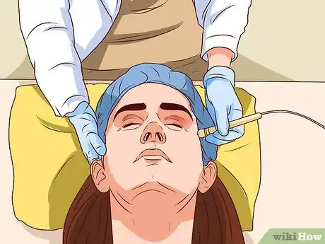 Image titled Get Rid of Age Spots Step 4