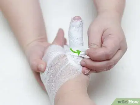 Image titled Strap a Thumb Step 10