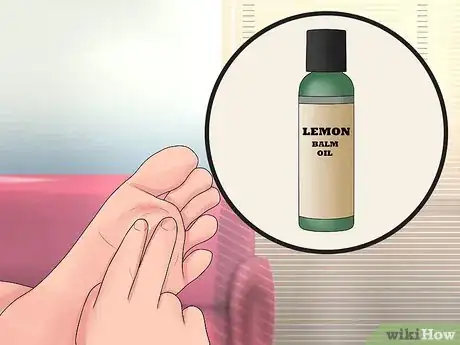 Image titled Apply Balm to Cramped Muscles Step 4