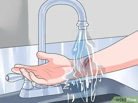 Image titled Recognize and Prevent Valley Fever (Coccidioidomycosis) Step 13