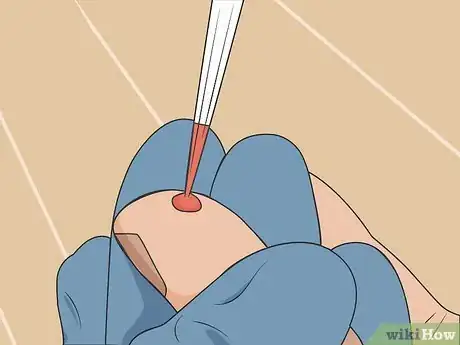 Image titled Find Out if You Have Already Had Coronavirus Step 05