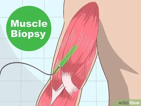Image titled Diagnose Mitochondrial Disease Step 17