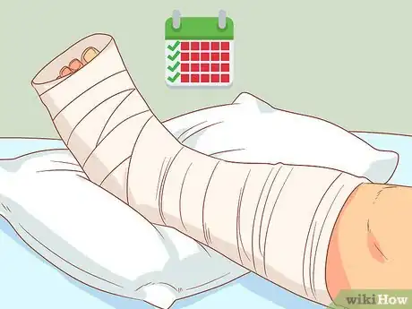 Image titled Heal Bones Faster After Surgery Step 14