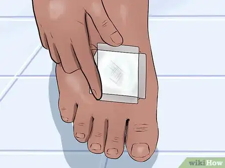 Image titled Care for a Cut Step 5