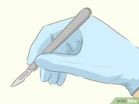 Image titled Prevent Cluster Headaches Step 11