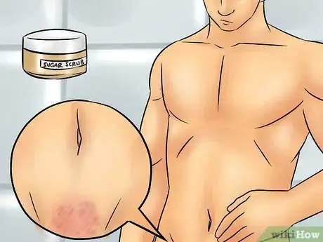 Image titled Deal With Pubic Hair Step 8