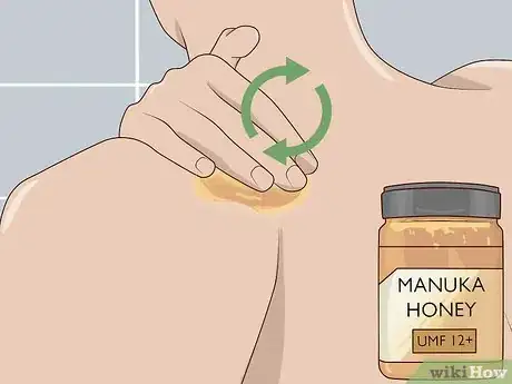 Image titled Use Honey as a Topical Antibiotic Step 10
